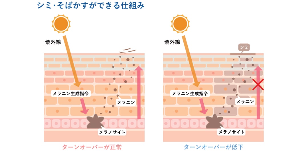 >シミそばかすができる仕組み