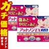 コスメ通販　【第2類医薬品】アットノンEXジェル 15g×2個