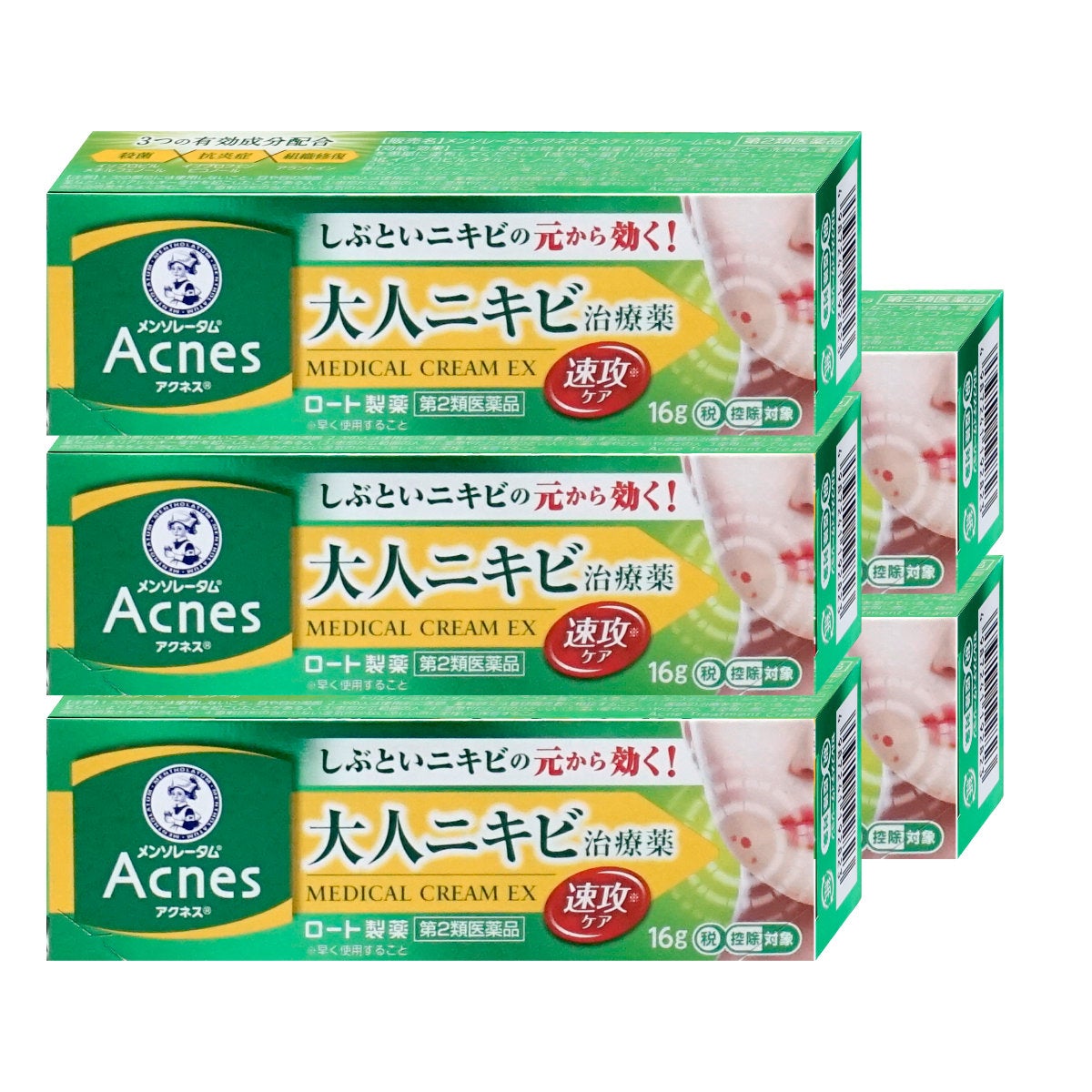 通販　【第2類医薬品】【セット】メンソレータム アクネス25 メディカルクリームEXa 16g×5個(セルフメディケーション税制対象)【ロート製薬】【皮膚の薬】